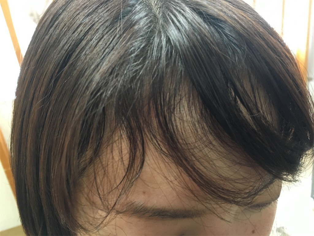 うねり 前髪 内側 前髪の内側がうねうね…前髪のくせ毛を上手に自分できる方法