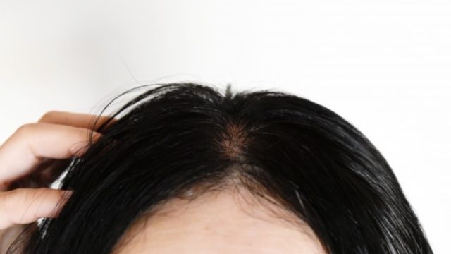 Lineにてご質問 夕方になると髪の毛が濡れたように束になることが悩み Liss 恵比寿 フリーランス美容師のみの美容室 代表 渡辺真一 地毛に戻す美容師 コンプレックス お悩み相談 Lineにてご質問 夕方になると髪の毛が濡れたように束になることが悩み Liss 恵比寿 フリーランス美容師のみの美容室 代表 渡辺真一 地毛に戻す美容師 コンプレックス お悩み相談