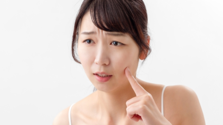 ヘアオイル 洗い流さないトリートメント で顔が肌荒れしてしまう原因は Liss 恵比寿 フリーランス美容師のみの美容室 代表 渡辺真一 地毛に戻す美容師 コンプレックス お悩み相談